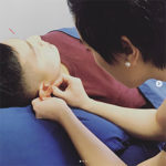 This is an image of Dr. Khanita placing acupuncture needles on a male client's ear.